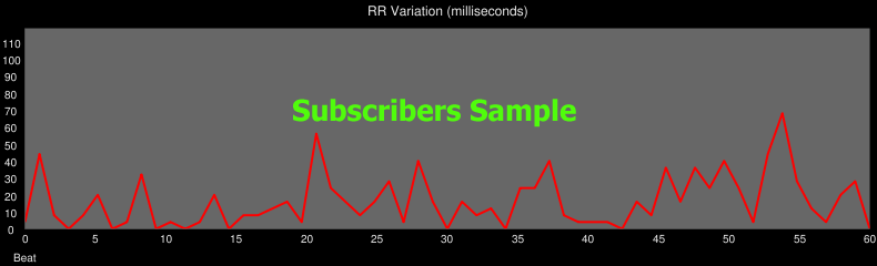 Heart RR Variations Chart Sample